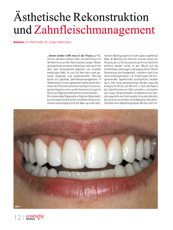 Ästhetische Rekonstruktion und Zahnfleischmanagement